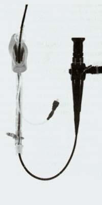 Fiberoptic Intubation via LMA